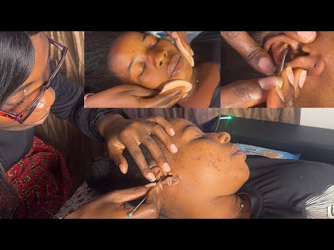ASMR BEST SLEEP THERAPY FOR THOSE WHO HAVE INSOMNIA WITH CHEW GUM
