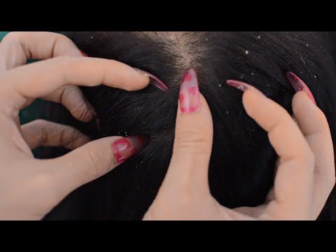 ASMR Relaxing Scalp Check With Long Nails / Scalp Scratching On Real Person For Deep Sleep
