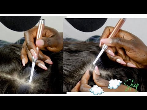 Rare and Super ATTENTIVE NITPICKING LICE eggs from his scalp 
