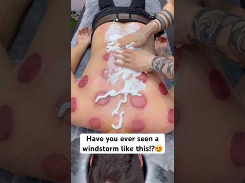 😍❤️‍🔥#shorts #shortvideo #short #explore #massage #asmr #cupping #trend #viralshorts #viralvideo