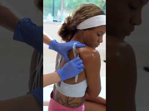ASMR Muscle Knots Releases *Back Cracks* #chiropractor #shorts