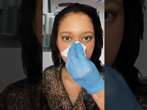 Rinoplastia clandestina #asmr #pov