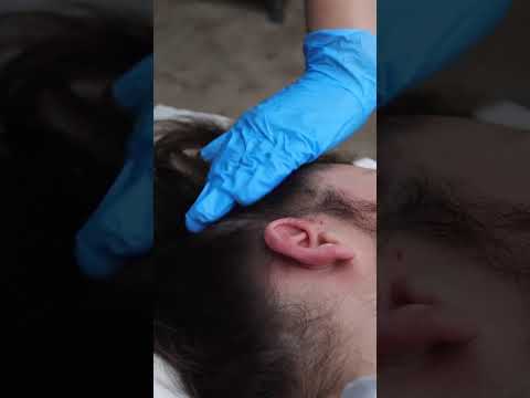 ASMR Real Person Scalp Sensation Sharp Dull Testing | unintentional medical asmr