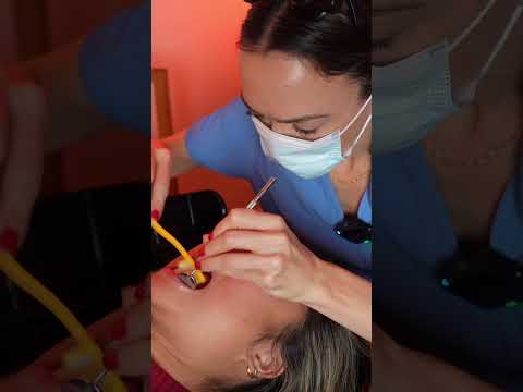 Asmr dental #asmr #asmrsounds #asmrvideo #relaxing #relax #satisfying #satisfyingvideo #tingles