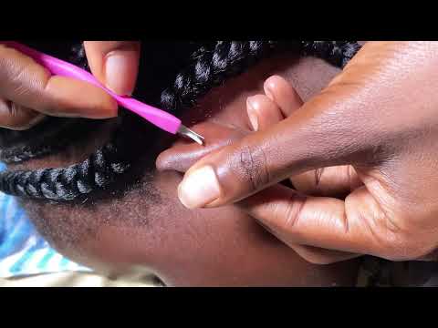 ASMR HOW NIT-PICKED MY SISTERS EARS AND SHE FELL ASLEEP SO RELAXING