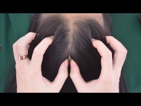 ASMR Head Scratching Massage, Aggressive Scratch Sounds With Nails For Headache Relief