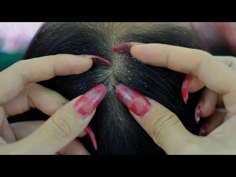 ASMR Scalp Check, Scalp Scratching, Head Scratching With Long Nails Relaxing For Sleep (  1 hour + )