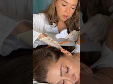 Asmr scalp tingles #asmr #asmrsounds #asmrvideo #relax #relaxing #satisfying #hair #sleep #tingles