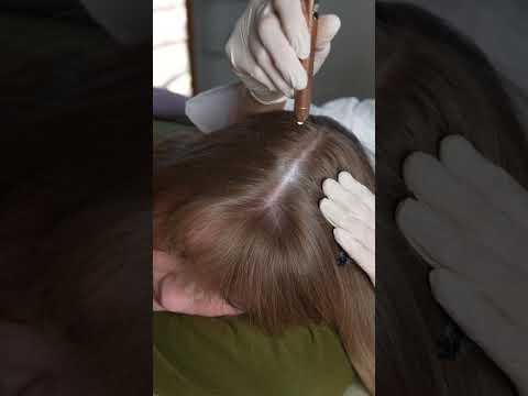 Asmr scalp 💆🏻‍♀️ #asmr #asmrsounds #asmrvideo #relax #relaxing #satisfying #hair #tingles #sleep