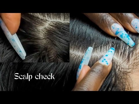 ASMR High Concentration Scalp Inspection~TINGLY parting | for DEEP Sleeep 🥱