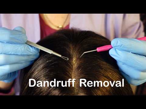 ASMR ~ Satisfying Dandruff Removal & Scalp Check (Whispered)