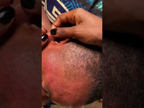 Asmr best sleep therapy #asmr #satisfying #tinglyfeeling #relaxing