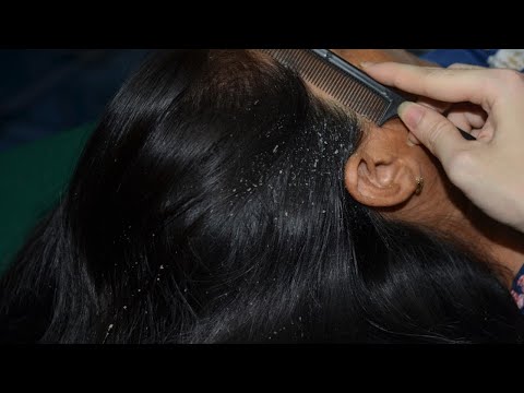 ASMR Scalp Scratching, Nape Scratching, Hair Brushing For Deep Sleep ( No Talking )