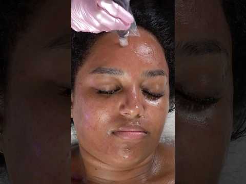 ASMR Microneedling with Tanya Marie