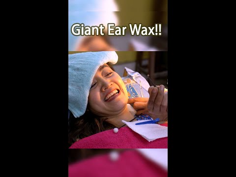 Giant Ear Wax -  First time Ear Cleaning #Shorts