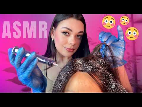 ASMR: Removendo Sua Caspa Até Você Dormir 😴