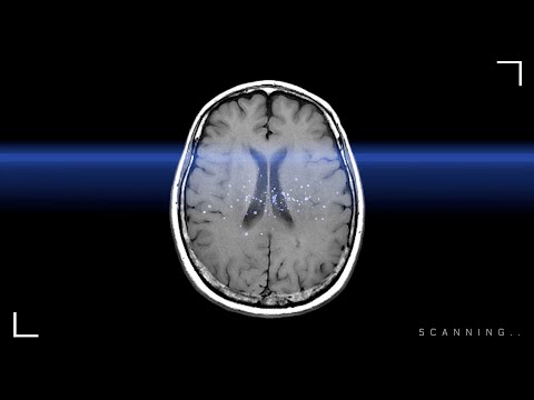 𝗔𝗦𝗠𝗥 뇌스캔 해보니 팅글 아직 있으신데요? ⚠️빠른 고자극 주의