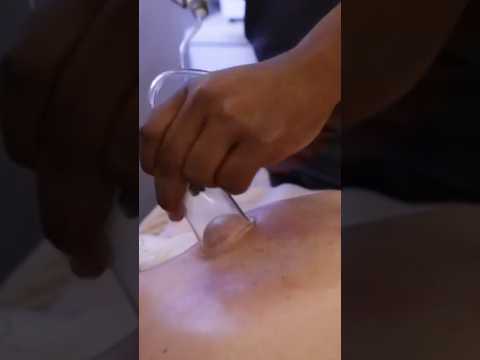 Masaje de espalda con ventosas #asmr #shorts #vacuum