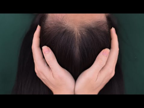 ASMR Scalp Scratching Aggressive For Relieve Stress ( No Talking )