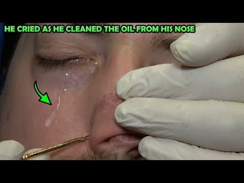 HE CRIED WHILE GETTING NOSE OIL 💈 LOUD CRACKS 💈 NOSE WAX 💈 EAR BURN 💈 ASMR HEAD, CHEST FOAMY MASSAGE