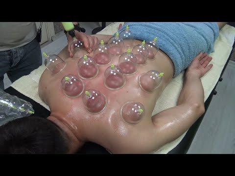 ASMR body cupping massage & BACK CRACK & amazing  back,ear,elbow,foot,ax,leg,head,face,arm massage