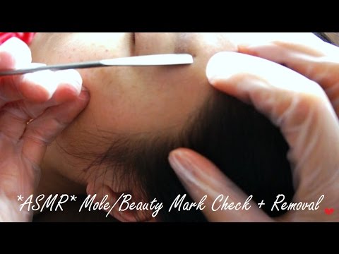 ASMR SKIN CHECK UP - MOLE/ BEAUTY MARK EXAMINATION + REMOVAL !! (practice lol)