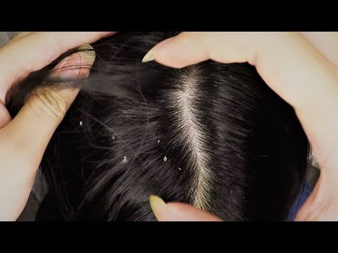ASMR | Dry Scalp Scratching & Head Massage for Sleep