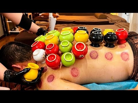 ASMR 🇻🇳 Have You Ever Seen Cupping Like This? | Vietnamese Therapy