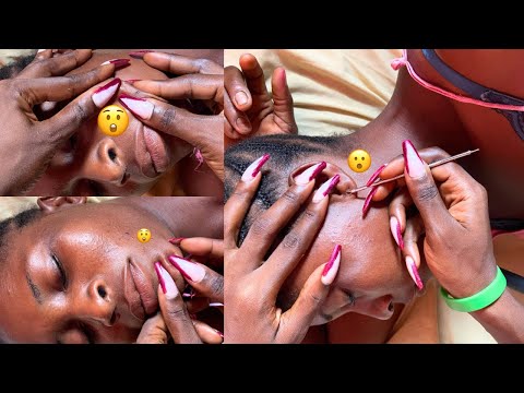 🌟ASMR 🌟SUPER ATTENTIVE FACE, EAR HOLE PICKING & HAIR SCRATCH