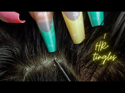 {ASMR} 1 HR + Super Attentive NITPICKING SCALP WHITEHEADS | zoomed | soft whispers