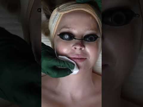 Get Glowing Skin: The "No-Peel" Peel You NEED! #shorts
