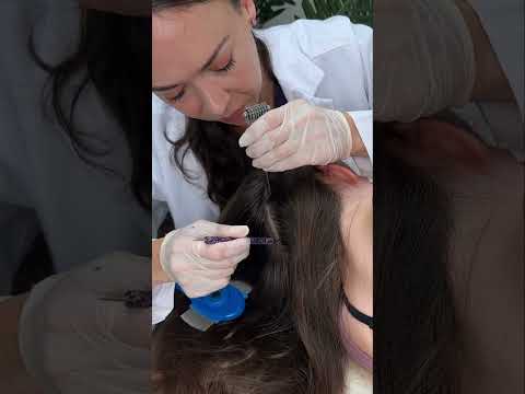 Asmr scalp tingles #asmr #asmrsounds #asmrvideo #relax #relaxing #satisfying #hair #sleep #tingles