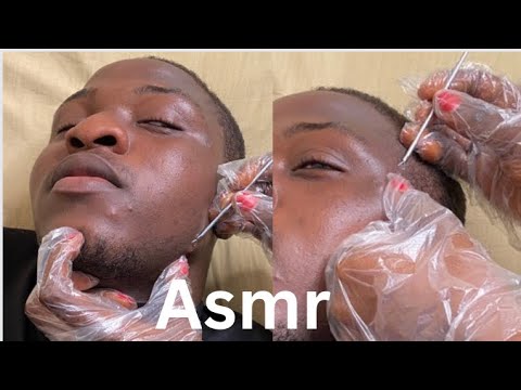 Your Favorite Extraction - Tiny Nits On The Face