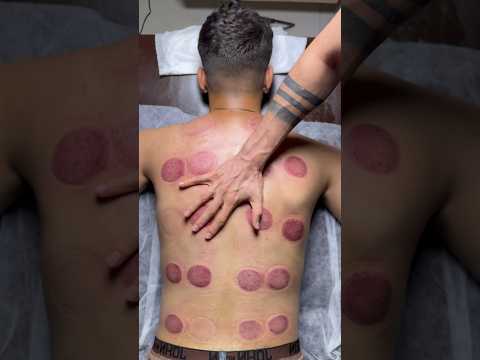 "asmr"vip cupping#fyp #viral #shorts #viralshorts #explore