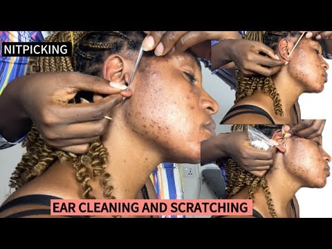 ASMR Ear Cleaning & Nitpicking for Sleep | Deep Tingles & Personal Attention Sounds