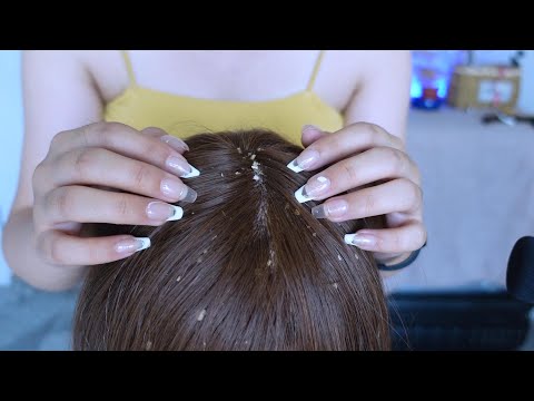 ASMR | Dandruff Removal & Scalp Check Extremely Satisfying