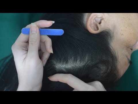 ASMR Nape Scratching, Hair Parting And Scalp Massage Sounds For Anxiety Relief