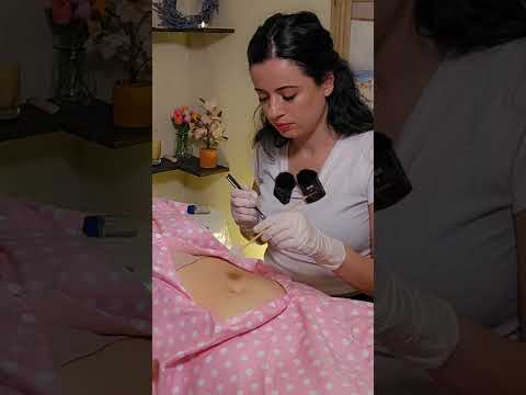 ASMR Abdomen Exam & Measuring