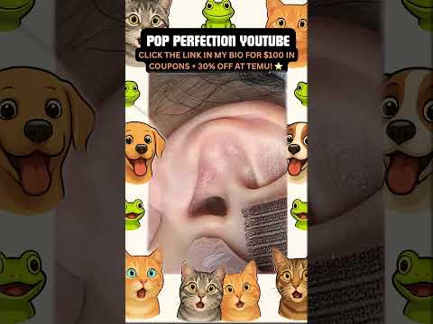 Wow! #pimpleremoval #pimple #pimples #shortsfeed #shortvideo #shorts #short #youtube #youtubeshorts