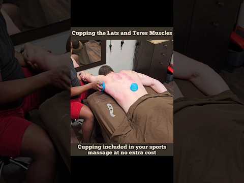Sports Massage Cupping Coach's Lats #massage #sportsmassage #houston