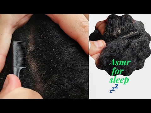 ASMR Real Person | Tingly Scalp SCRATCHING after braids ~ for the best sleep 😴