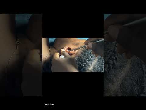 ASMR Sleep Doctor Roleplay: Deep Ear Cleaning, Back & Scalp Scratching for Tingles