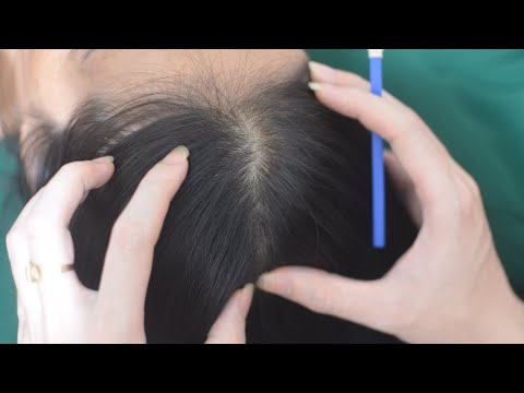 ASMR Intense Head Scratching, Hair Aggressive, Scratch Sound For Anxiety Relief