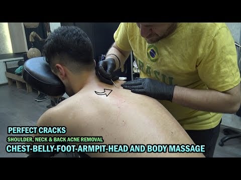 💈 DEEP SHOULDER & NECK ACNE REMOVAL - LOUD CRACKS - ASMR BARBER head,face,chest,belly,armpit massage
