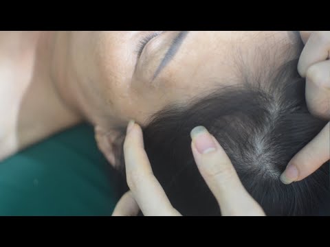 ASMR Real Person Head Scratch, Hair Tingles Sounds, No Talking For Relieve Anxiety, Stress