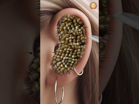 Sonu Bhene Ke kaan me kitenu | By Asmr #shorts