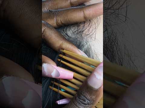 What i found nitpicking my husbands hair | FULL VIDEO ON OUR YOUTUBE CHANNEL #asmr #shorts #hairtok