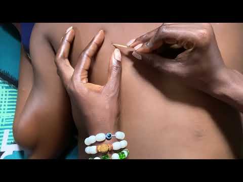 ASMR BACK MASSAGE AND NITPICKING FOR DEEP SLEEP @AsmrbyBecserah