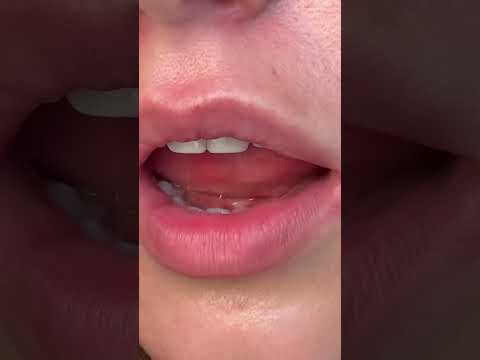 #kiss #asmr
