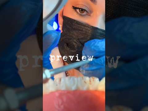 Sua primeira vez no dentista 🦷 #asmr #pov #dentista #shorts